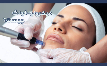 میکرونیدلینگ چیست