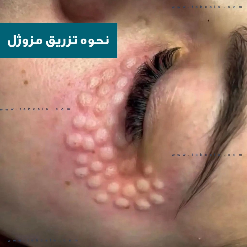 جالپرو یانگ آی 