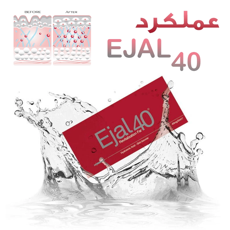 مزوژل اجال 40