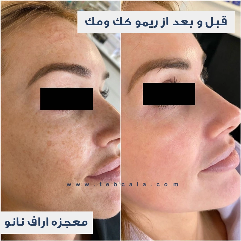 آراف نانو