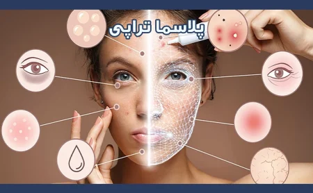 پلاسما تراپی
